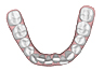 Invisalign Clincheck Ober- und Unterkieferansicht