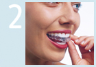 Foto: Wie funktioniert Invisalign® Schritt 2