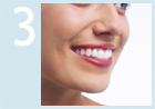 Foto: Wie funktioniert Invisalign® Schritt 3